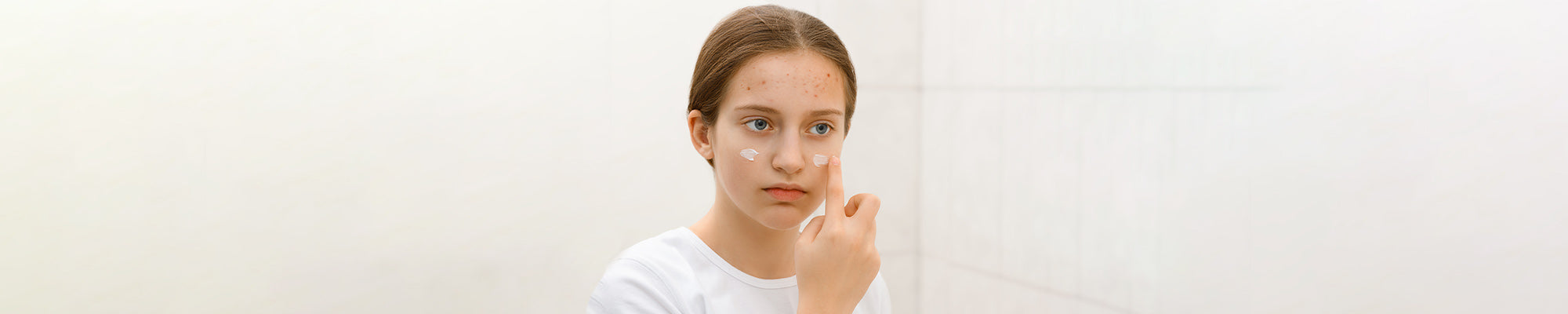 Is Acne Cream Supposed to Burn? An Investigative Piece