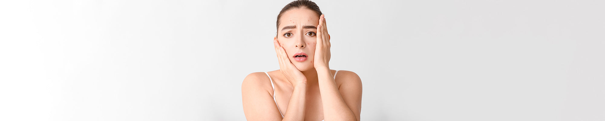 Subclinical Acne: Treatment Options and What You Should Know