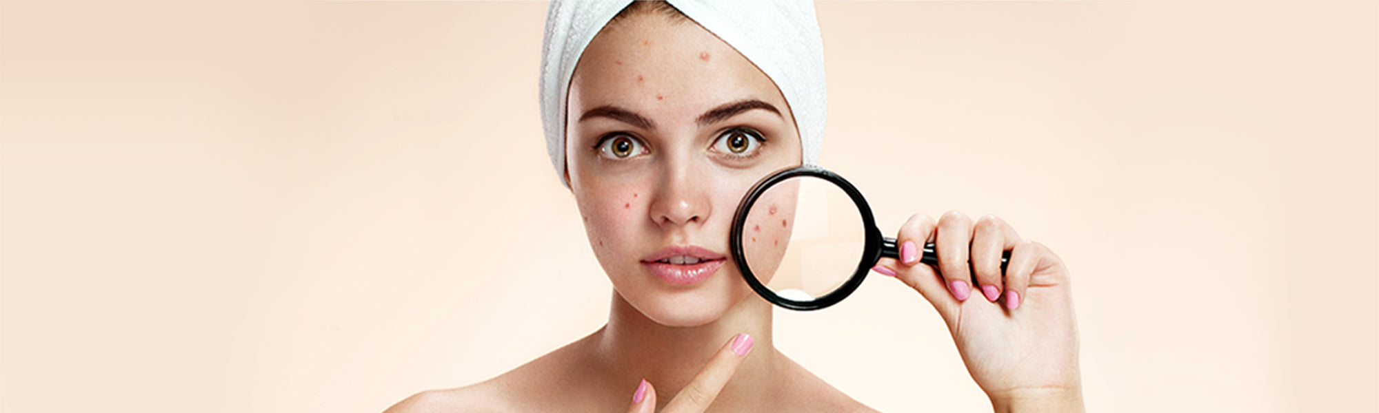 What is the Difference Between Acne and Pimples?