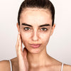 What is the Right Way to Treat Acne?